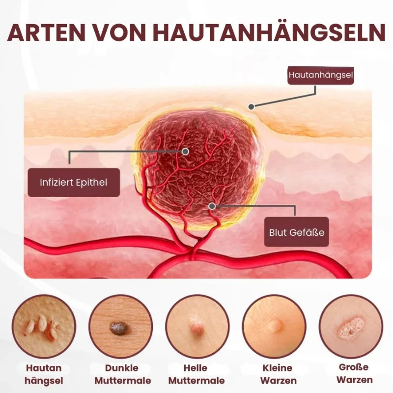 Vorschaubild 11
