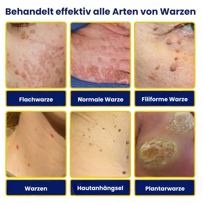 Vorschaubild 6